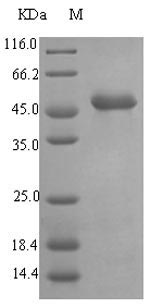 Recombinant Pseudomonas aeruginosa Elastase (lasB) - 20 ug